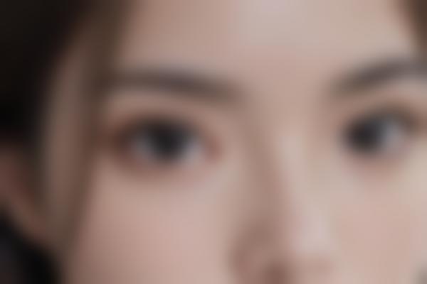 河北邯郸曲胜医生整形修复怎么样？曲胜医生技术稳、资质全，眼部鼻部综合塑造自然美！