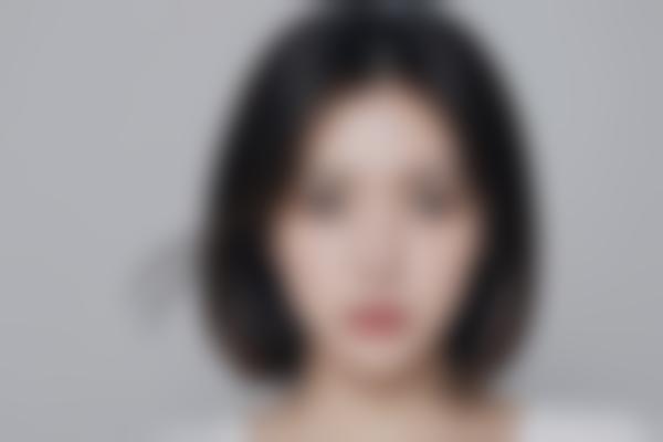 为什么潘彦龙修复的双眼皮更自然？
