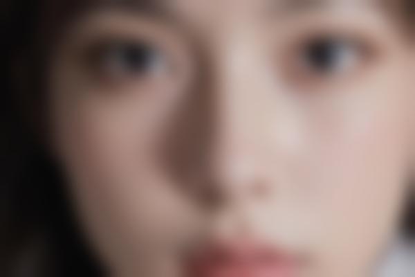 佛山顺德亚美李龙军整形技术好吗？10年经验医生打造自然精致五官！