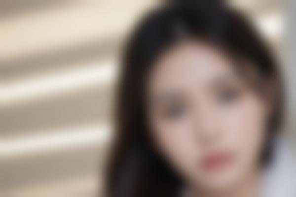武汉医院曹玮医生整形修复，20年经验打造自然精致美