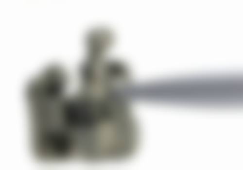 西安话小白兔口腔时代天使隐形矫正22000+ · 笑出兔牙弯弯月，轻松变美没得麻烦