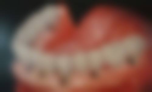 技术层面：治疗方案的个性化决定了价格弹性