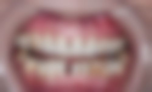 四、盐城士林口腔设备介绍