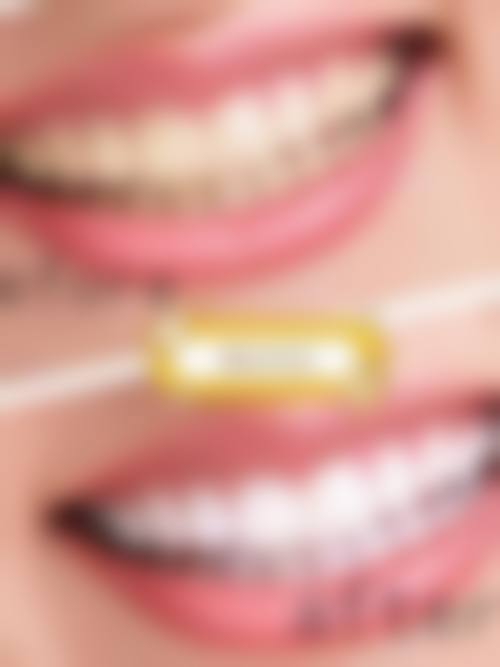 三、广东佛山市德伦口腔(容桂旗舰院)核心科室与特色项目