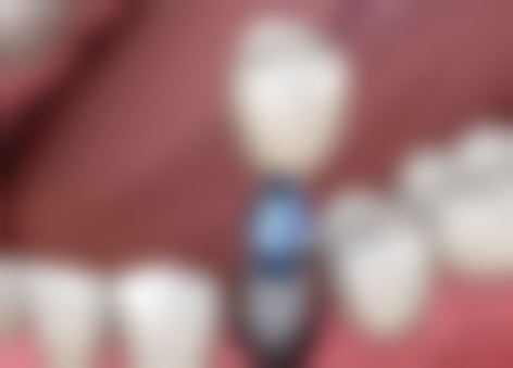 四、昆山美洁净口腔设备介绍