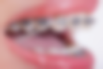 三、黄冈皓清齿科门诊（赤壁大道院)核心科室与特色项目