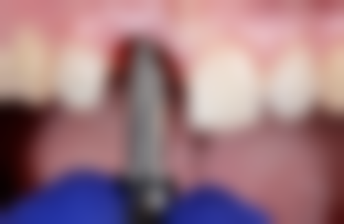 五、浙江大学医学校附属第四 医院口腔正畸门诊舒适就医环境,打造人性化诊疗体验