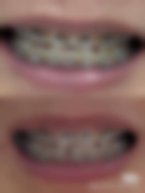 二、杭州美玉口腔诊所(下城区)医生团队，打造专精诊疗服务