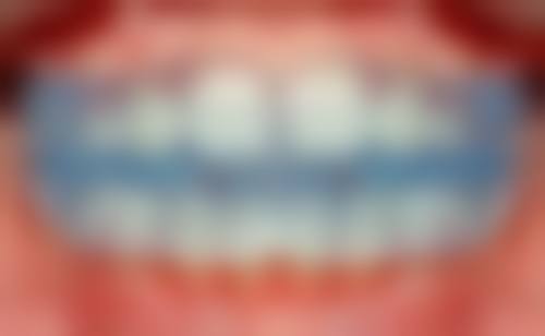 四、北京维尔口腔甘露园分店设备介绍