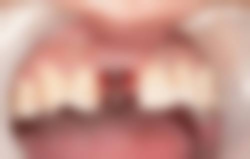 七、喀什柏赛佳口腔门诊部就医指南，便捷就诊不迷路