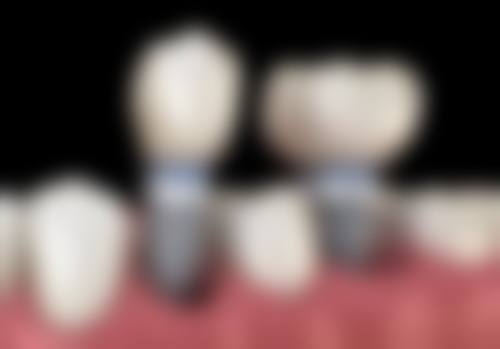 七、吉首市斑马牙医口腔门诊部就医指南，便捷就诊不迷路