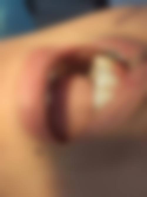 七、鄞州陈佳囡口腔诊所就医指南，便捷就诊不迷路