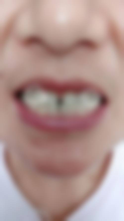 二、河南新乡获嘉县文献口腔医生团队，打造专精诊疗服务