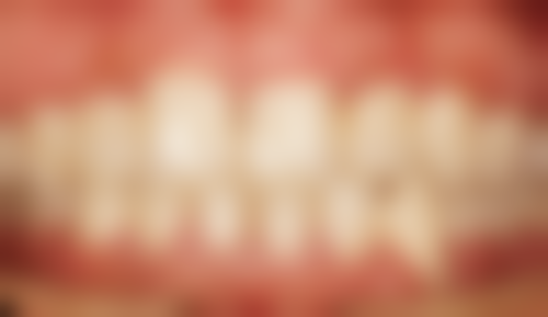 安阳北关添悦口腔门诊部种植牙优缺点分析&适应人群