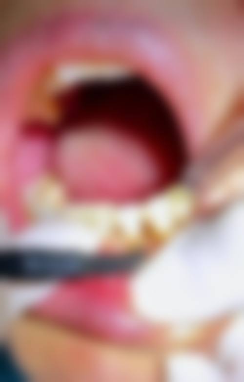 七、宁波明扬口腔就医指南，便捷就诊不迷路