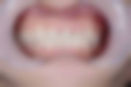 四、广州穗华口腔(东圃院区)设备介绍