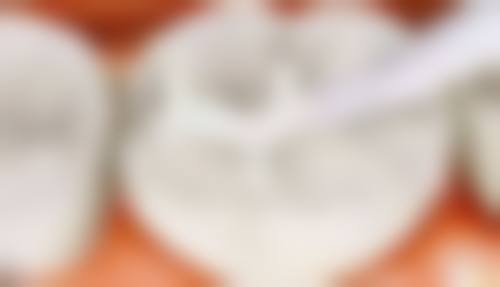 三、泉州星雅口腔核心科室与特色项目