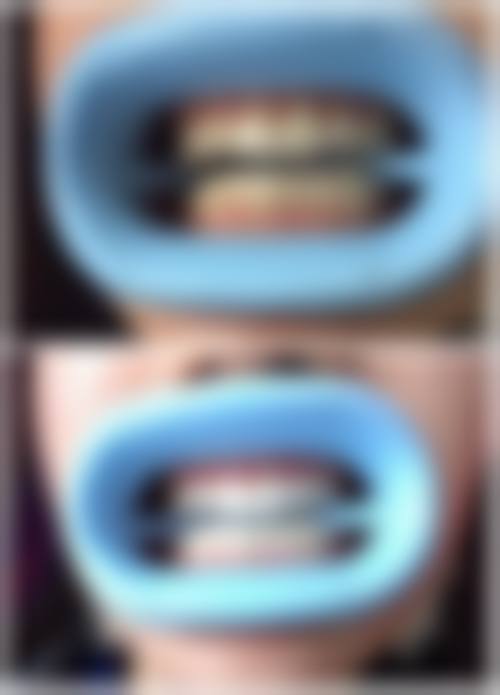 六、山东潍坊诸城王璐口腔荣誉资质与患者口碑,见证品牌实力