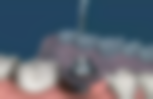 六、广州雅度口腔门诊部荣誉资质与患者口碑，见证品牌实力