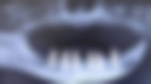 七、秦皇岛口腔医院连锁就医指南，便捷就诊不迷路