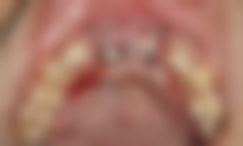 二、广东东莞长安优牙口腔门诊部医生团队，打造专精诊疗服务