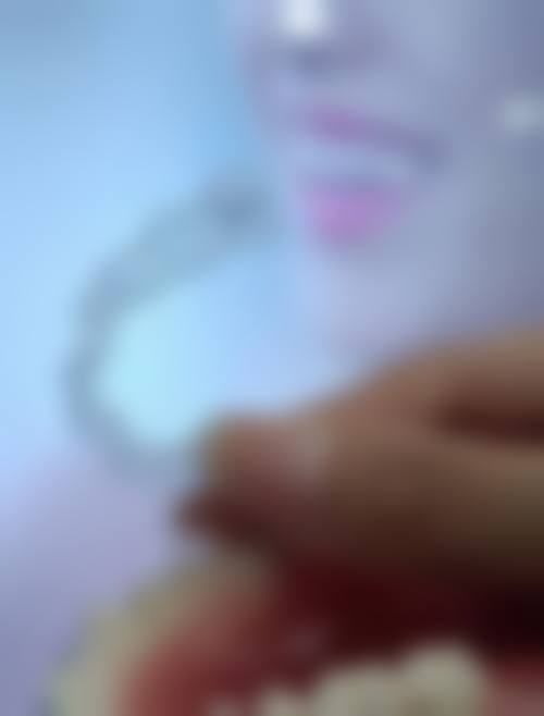 四、秦皇岛口腔医院连锁设备介绍