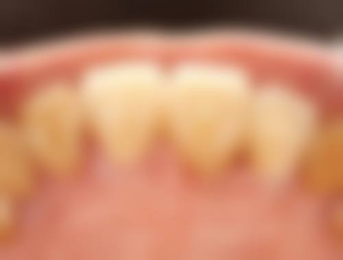 七、武汉贝贝口腔连锁就医指南,便捷就诊不迷路