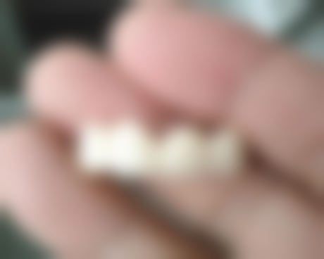 四、北辰时代口腔设备介绍