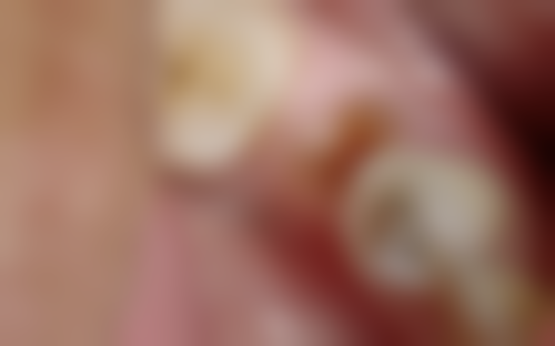 五、河南驻马店平舆县刘勇（牙博士）口腔舒适就医环境，打造人性化诊疗体验