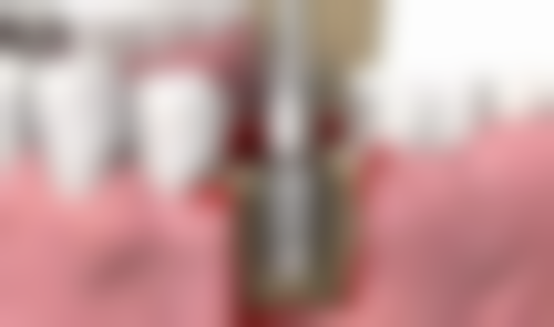 七、益阳众美口腔诊所就医指南，便捷就诊不迷路