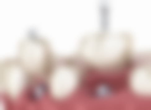 六、浙江宁波鄞州瑞阁口腔荣誉资质与患者口碑，见证品牌实力