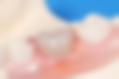 五、准格尔旗中蒙医院口腔科舒适就医环境,打造人性化诊疗体验