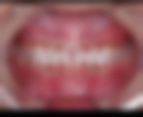 四、东莞叶子口腔门诊部(南城街道)设备介绍