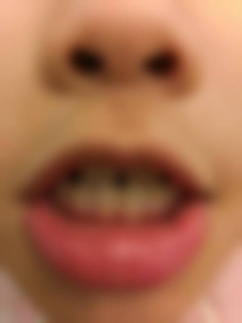 七、盐城尚爱口腔门诊部就医指南，便捷就诊不迷路