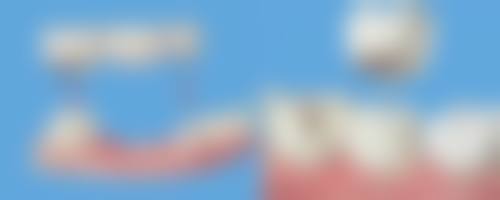 三、深圳美诗口腔核心科室与特色项目