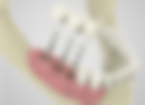 二、杭州美奥口腔(学院路店)医生团队,打造专精诊疗服务