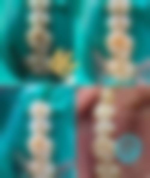 二、昆山樾河路口腔专科门诊部医生团队,打造专精诊疗服务