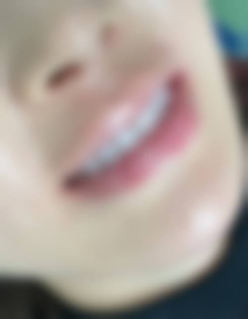 七、泉州南安艾美口腔就医指南，便捷就诊不迷路