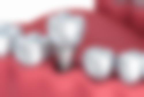 三、盐城潘永伟口腔门诊部核心科室与特色项目