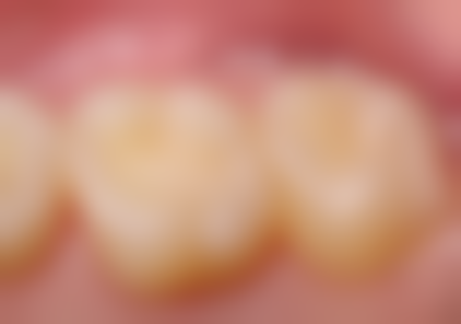 二、思茅区博德口腔诊所医生团队,打造专精诊疗服务