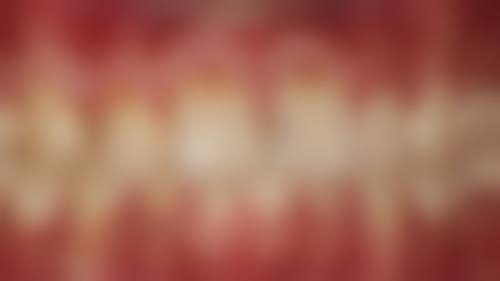 四、广州惠城惠佳美口腔设备介绍