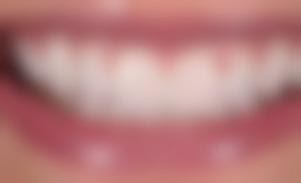 五、陕西咸阳秦都木子口腔舒适就医环境，打造人性化诊疗体验