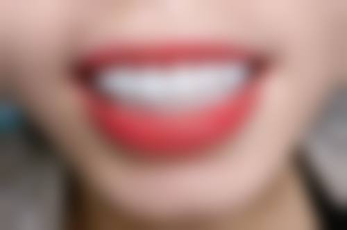 四、西安高陵宋文鸣口腔诊所设备介绍