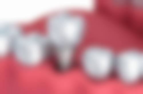 五、杭州亚典口腔门诊部上沙店舒适就医环境，打造人性化诊疗体验