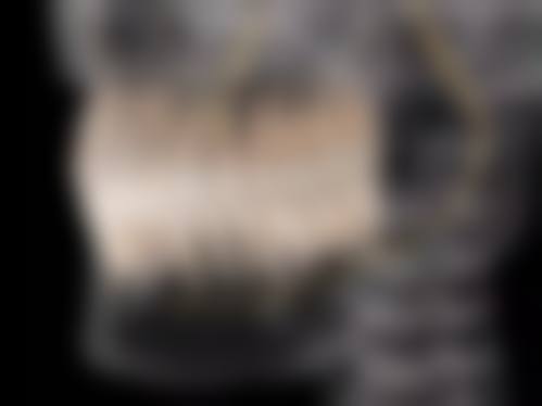 二、江苏无锡宜兴孙飞口腔诊所医生团队，打造专精诊疗服务