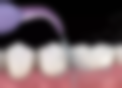 二、浙江衢州余立平口腔卫生站医生团队，打造专精诊疗服务