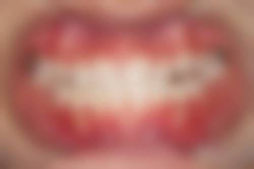 四、山东泰安东平精诚口腔设备介绍