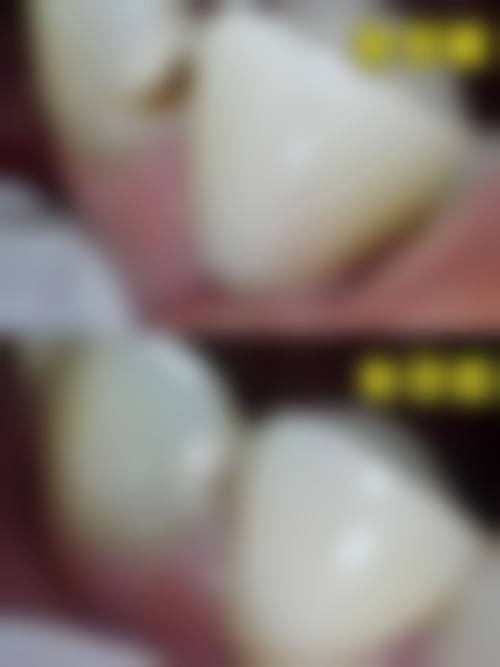 三、广东广州小象口腔核心科室与特色项目