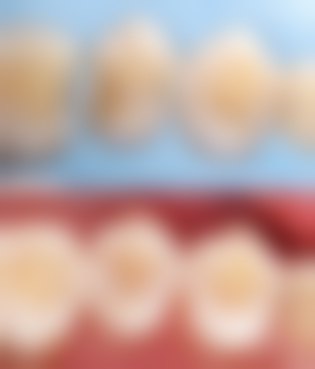 七、山东泰安东平精诚口腔就医指南，便捷就诊不迷路