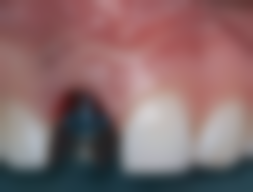 七、太原何炳玲口腔就医指南，便捷就诊不迷路